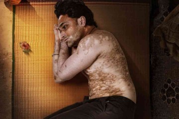Mahesh Gowda unveils poster for Bilichukki Hallihakki, a rom-com addressing vitiligo